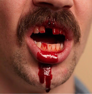 Meet your Posher, Mack